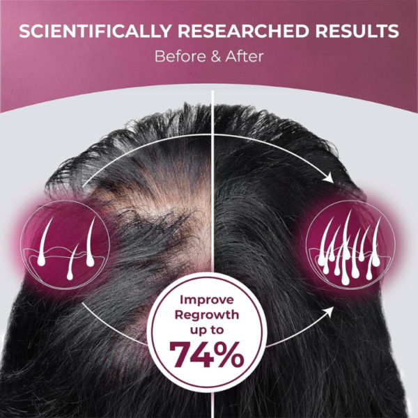potent-hair-growth-supplement-biotin